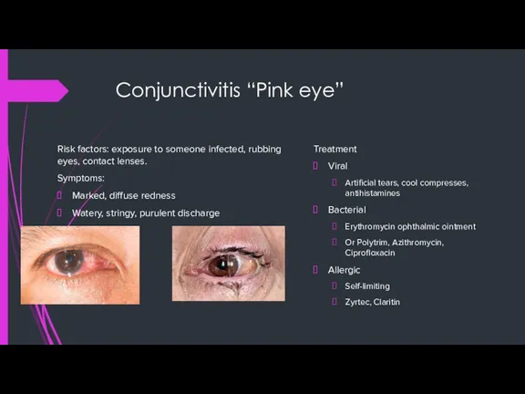 Conjunctivitis “Pink eye” Risk factors: exposure to someone infected, rubbing eyes, contact