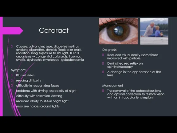Cataract Causes: advancing age, diabetes mellitus, smoking cigarettes, steroids (topical or oral),
