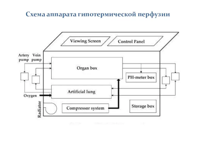 Схема аппарата гипотермической перфузии