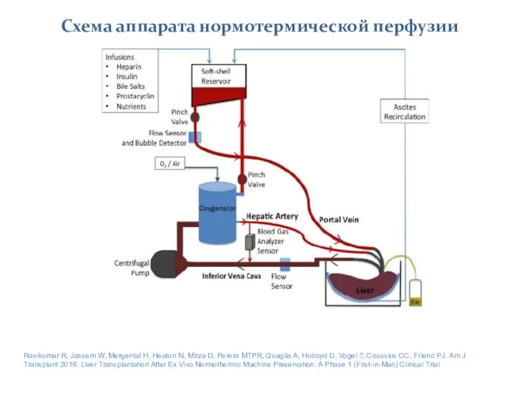 Схема аппарата нормотермической перфузии Ravikumar R, Jassem W, Mergental H, Heaton N,