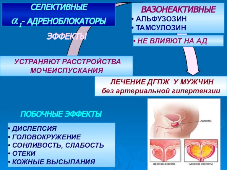 ЛЕЧЕНИЕ ДГПЖ У МУЖЧИН без артериальной гипертензии СЕЛЕКТИВНЫЕ α1- АДРЕНОБЛОКАТОРЫ