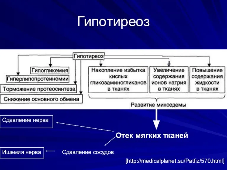 Гипотиреоз Отек мягких тканей [http://medicalplanet.su/Patfiz/570.html] Сдавление нерва Сдавление сосудов Ишемия нерва