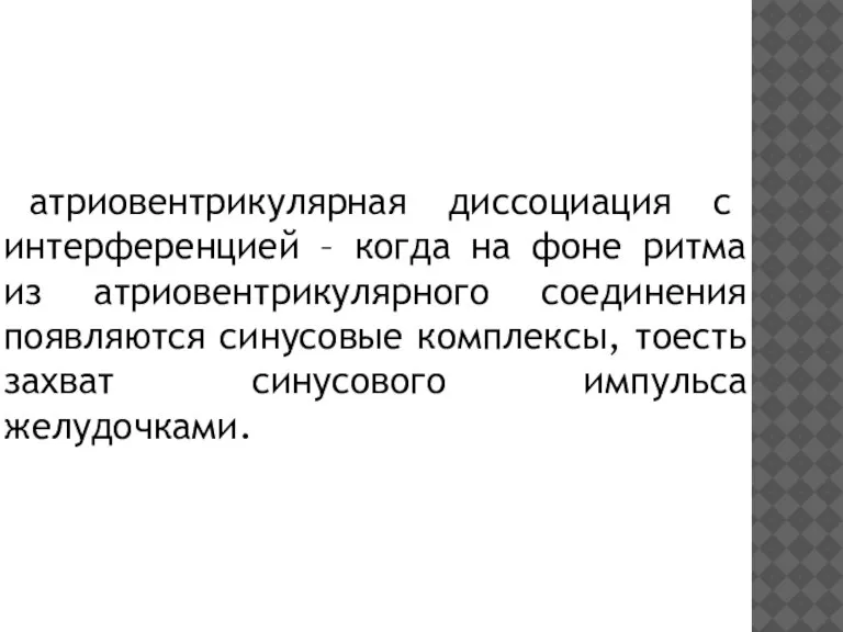 атриовентрикулярная диссоциация с интерференцией – когда на фоне ритма из атриовентрикулярного соединения