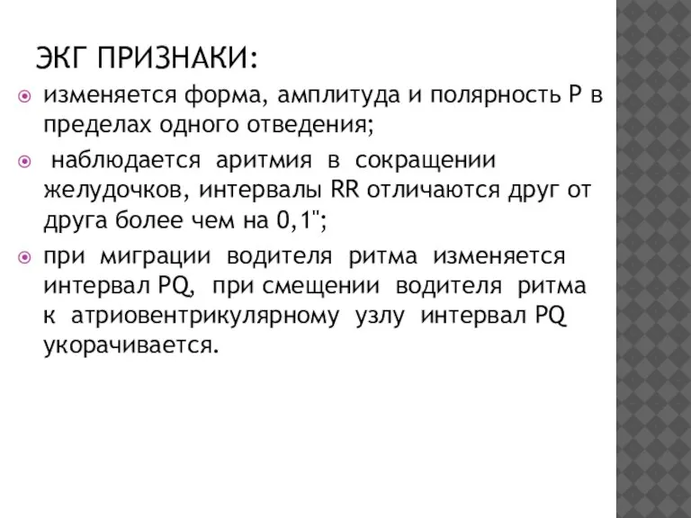 ЭКГ ПРИЗНАКИ: изменяется форма, амплитуда и полярность Р в пределах одного отведения;