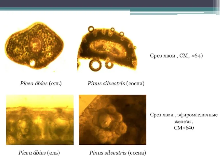 Pícea ábies (ель) Pinus silvestris (сосна) Срез хвои , эфиромасличные железы, СМ×640