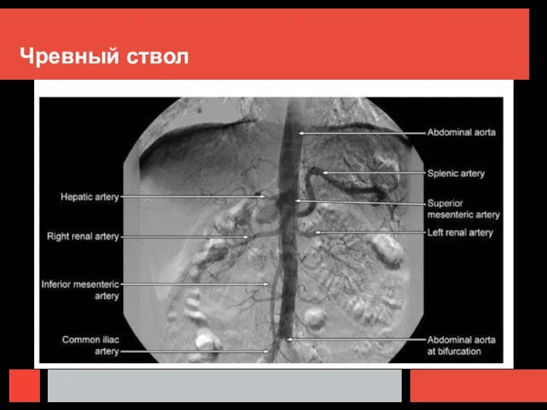 Чревный ствол