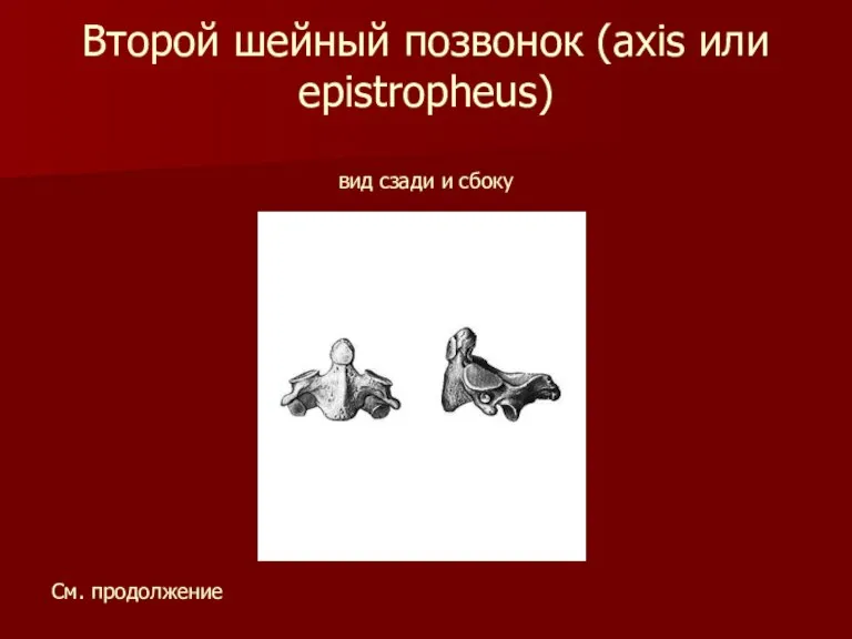 Второй шейный позвонок (axis или epistropheus) вид сзади и сбоку См. продолжение