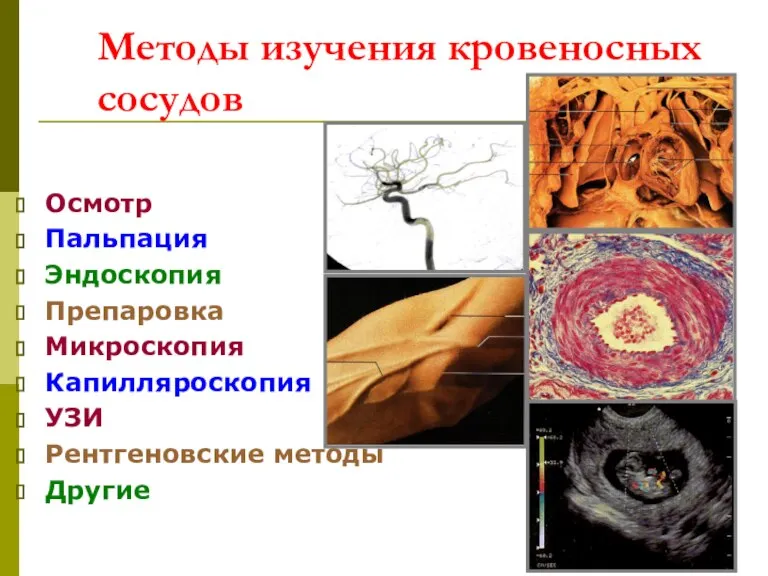 Методы изучения кровеносных сосудов Осмотр Пальпация Эндоскопия Препаровка Микроскопия Капилляроскопия УЗИ Рентгеновские методы Другие