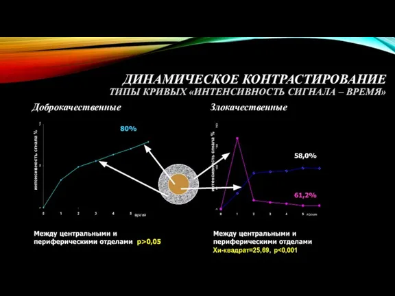 ДИНАМИЧЕСКОЕ КОНТРАСТИРОВАНИЕ ТИПЫ КРИВЫХ «ИНТЕНСИВНОСТЬ СИГНАЛА – ВРЕМЯ» Доброкачественные Злокачественные