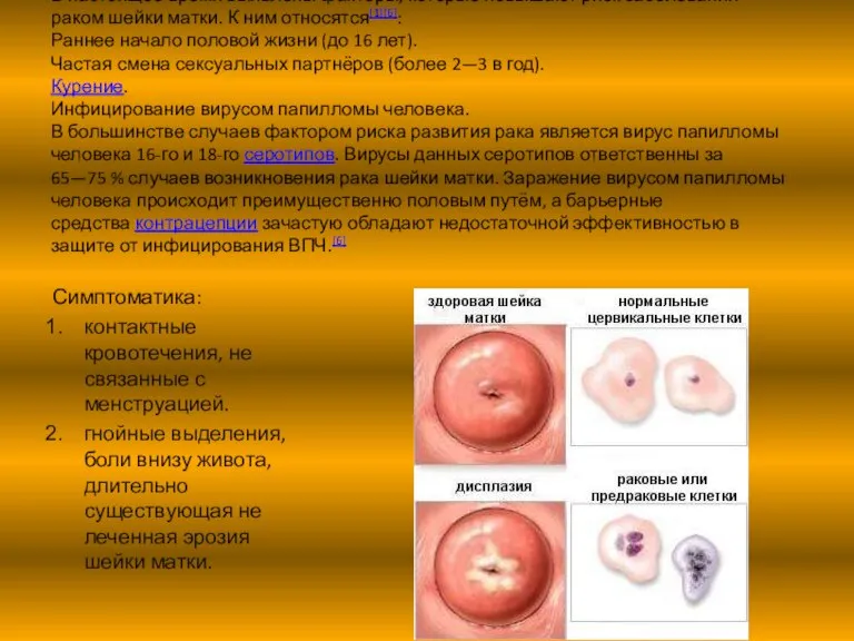 В настоящее время выявлены факторы, которые повышают риск заболевания раком шейки матки.