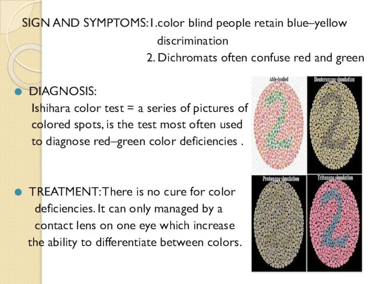 SIGN AND SYMPTOMS:1.color blind people retain blue–yellow discrimination 2. Dichromats often confuse