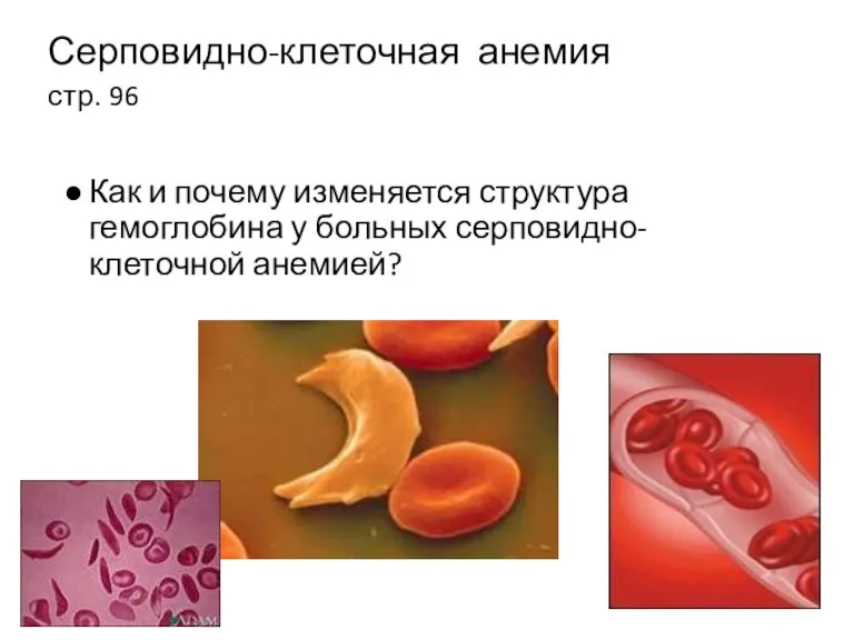 Серповидно-клеточная анемия стр. 96 Как и почему изменяется структура гемоглобина у больных серповидно-клеточной анемией?