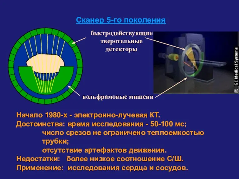 Сканер 5-го поколения Начало 1980-х - электронно-лучевая КТ. Достоинства: время исследования -