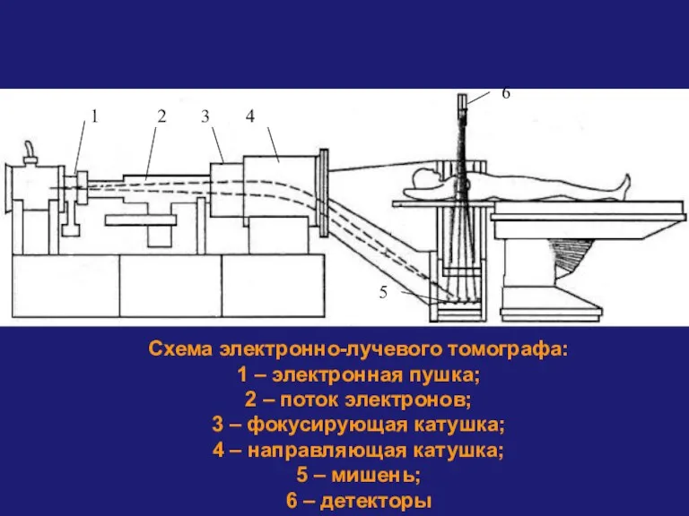 Схема электронно-лучевого томографа: 1 – электронная пушка; 2 – поток электронов; 3