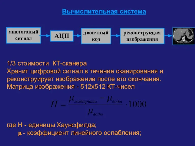 Вычислительная система 1/3 стоимости КТ-сканера Хранит цифровой сигнал в течение сканирования и