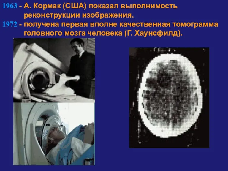 1963 - А. Кормак (США) показал выполнимость реконструкции изображения. 1972 - получена