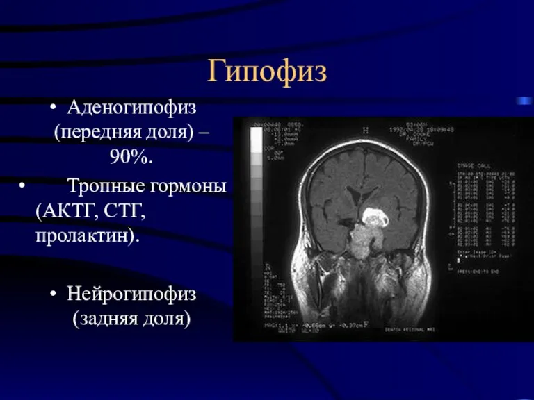 Гипофиз Аденогипофиз (передняя доля) – 90%. Тропные гормоны (АКТГ, СТГ, пролактин). Нейрогипофиз (задняя доля)