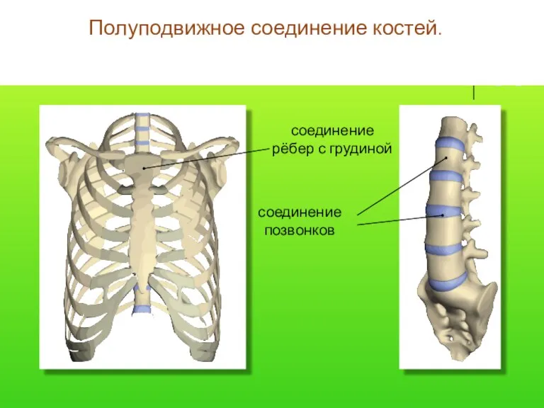 соединение позвонков Полуподвижное соединение костей. соединение позвонков соединение рёбер с грудиной соединение позвонков