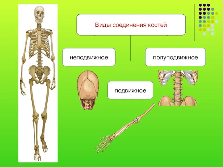 неподвижное полуподвижное Виды соединения костей подвижное