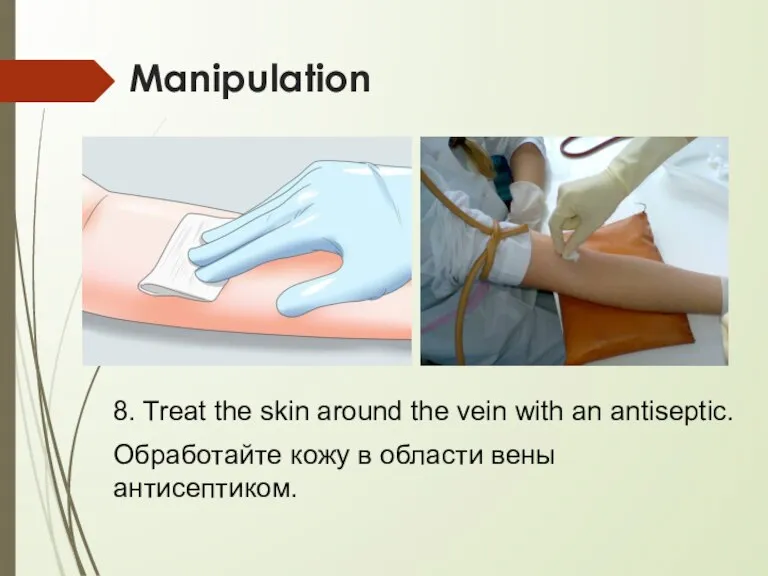 Manipulation 8. Treat the skin around the vein with an antiseptic. Обработайте