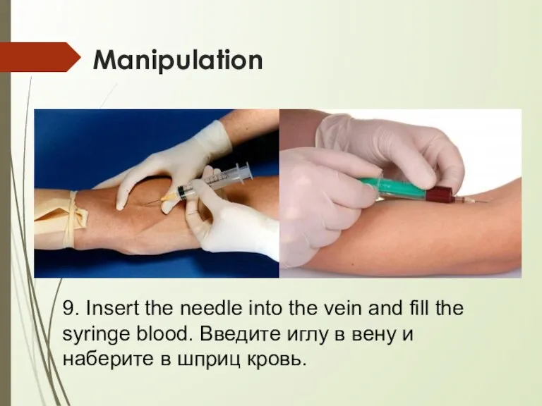 Manipulation 9. Insert the needle into the vein and fill the syringe