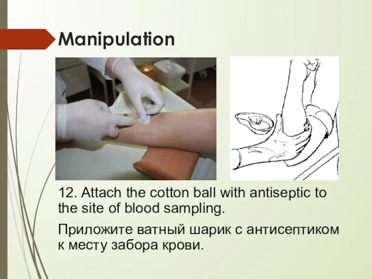 Manipulation 12. Attach the cotton ball with antiseptic to the site of