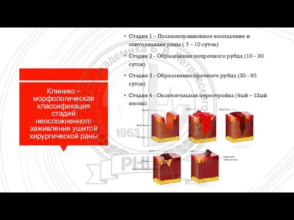 Клинико – морфологическая классификация стадий неосложненного заживления ушитой хирургической раны Стадия 1