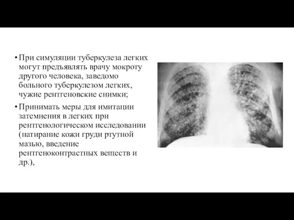 При симуляции туберкулеза легких могут предъявлять врачу мокроту другого человека, заведомо больного