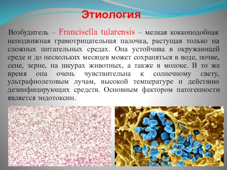 Этиология Возбудитель – Francisella tularensis – мелкая коккоподобная неподвижная грамотрицательная палочка, растущая