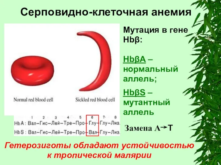 Серповидно-клеточная анемия Гетерозиготы обладают устойчивостью к тропической малярии Мутация в гене Hbβ: