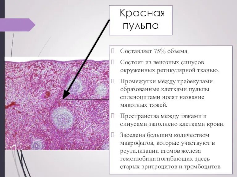 Красная пульпа Составляет 75% объeма. Состоит из венозных синусов окруженных ретикулярной тканью.