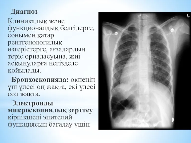 Диагноз Клиникалық және функционалдық белгілерге, сонымен қатар рентгенологилық өзгерістерге, ағзалардың теріс орналасуына,