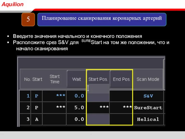 Введите значения начального и конечного положения Расположите срез S&V для SUREStart на