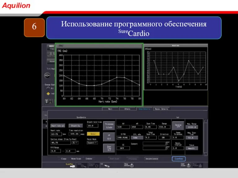 6 Использование программного обеспечения SureCardio Aquilion