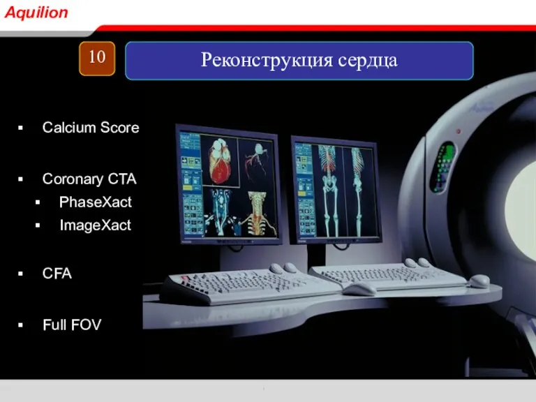 Calcium Score Coronary CTA PhaseXact ImageXact CFA Full FOV 10 Реконструкция сердца Aquilion