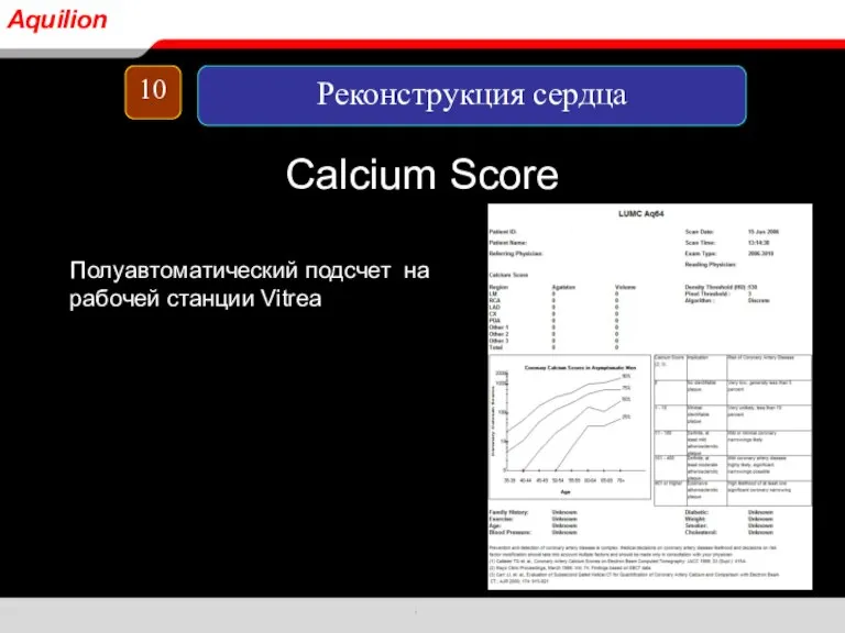 Calcium Score Полуавтоматический подсчет на рабочей станции Vitrea 10 Реконструкция сердца Aquilion