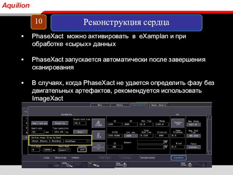 PhaseXact можно активировать в eXamplan и при обработке «сырых» данных PhaseXact запускается