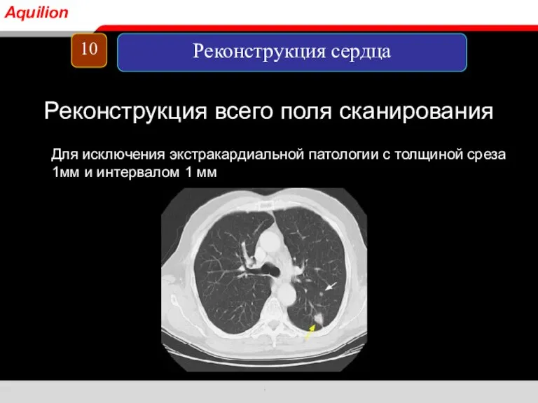 Реконструкция всего поля сканирования Для исключения экстракардиальной патологии с толщиной среза 1мм