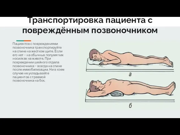 Транспортировка пациента с повреждённым позвоночником Пациентов с повреждениями позвоночника транспортируйте на спине