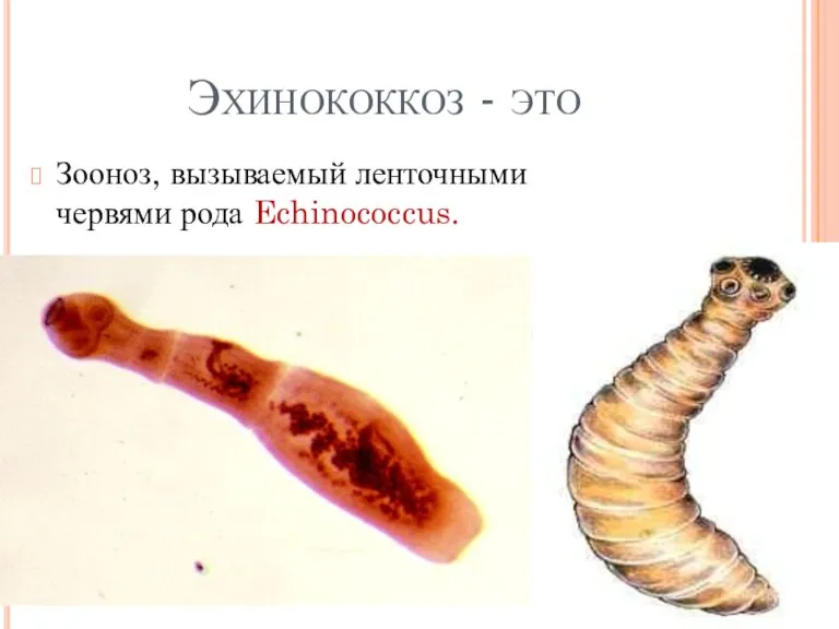 Эхинококкоз - это Зооноз, вызываемый ленточными червями рода Echinococcus.