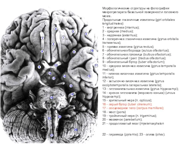 Морфологические структуры на фотографии макропрепарата базальной поверхности головного мозга. Продольные глазничные извилины