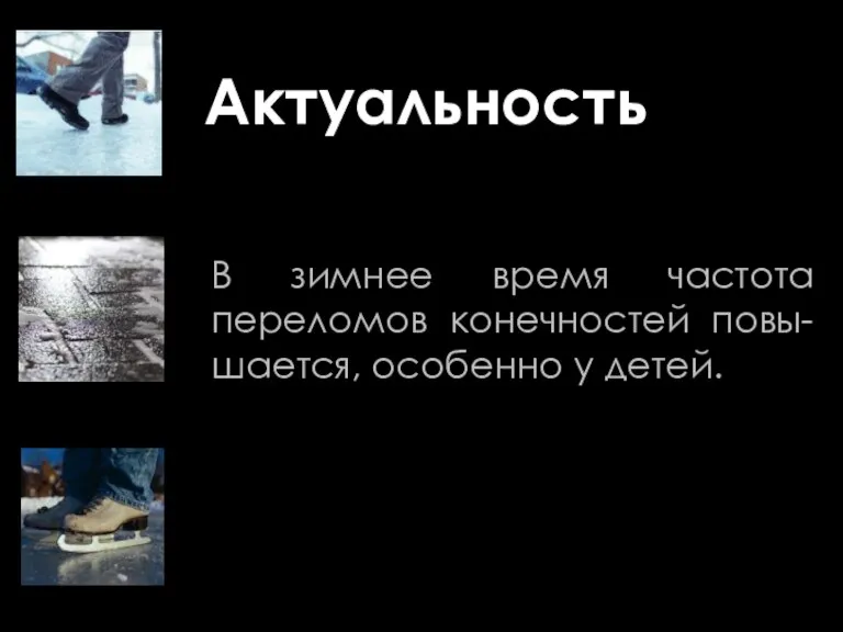 Актуальность В зимнее время частота переломов конечностей повы-шается, особенно у детей.