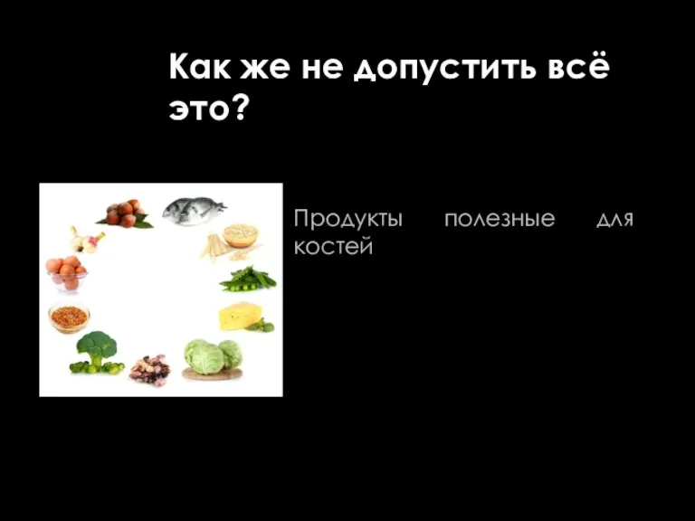 3D разборная анатомическая Продукты полезные для костей Как же не допустить всё это?