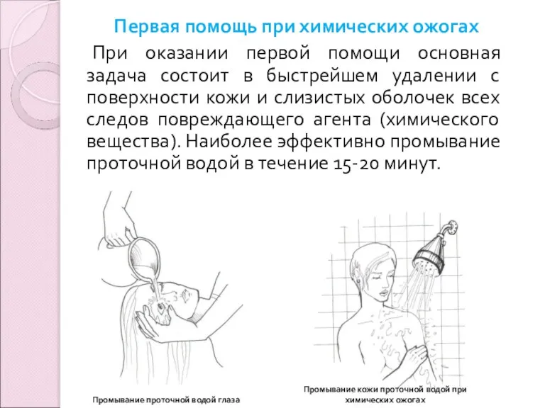 Первая помощь при химических ожогах При оказании первой помощи основная задача состоит