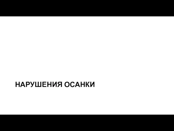 НАРУШЕНИЯ ОСАНКИ