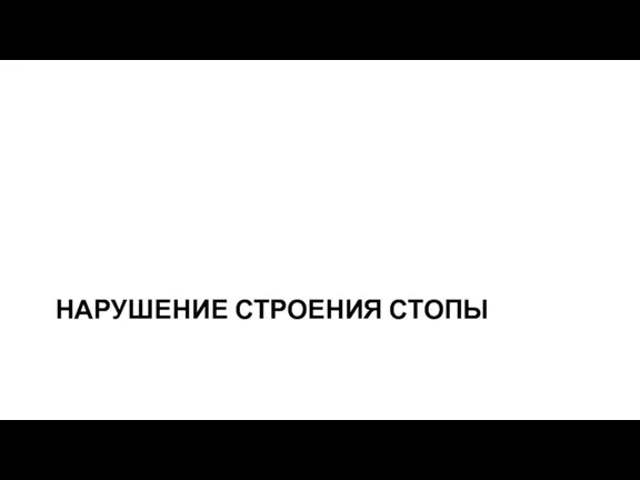 НАРУШЕНИЕ СТРОЕНИЯ СТОПЫ