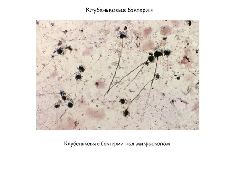 Клубеньковые бактерии Клубеньковые бактерии под микроскопом