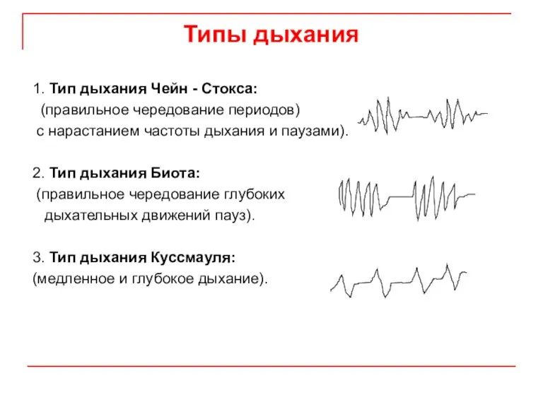 Типы дыхания 1. Тип дыхания Чейн - Стокса: (правильное чередование периодов) с