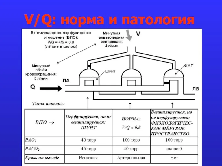 V/Q: норма и патология