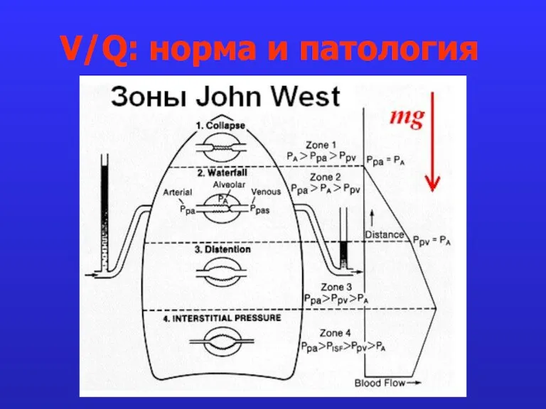 V/Q: норма и патология